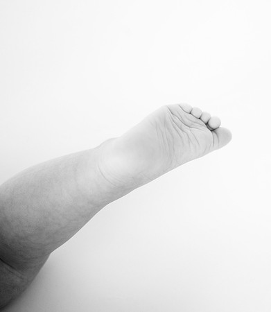 _KF34180