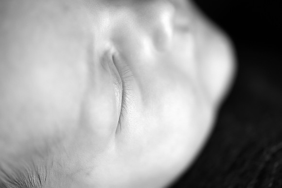_KF35563