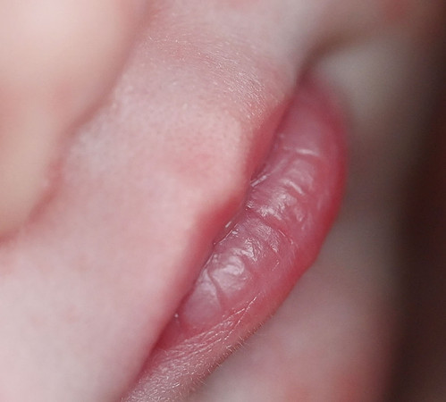 KFP_7815