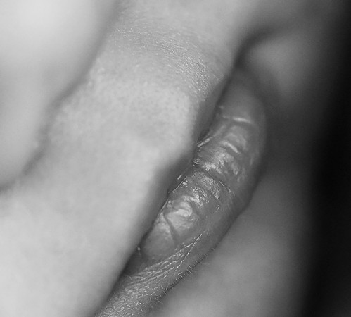 KFP_78151.
